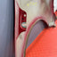 Citroen Berlingo/Peugeot Partner FRONT WING PASSENGER SIDE LEFT 2008 - 2018 P/N 7840W2